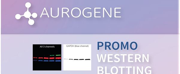 A new way to see the light... Western Blot
